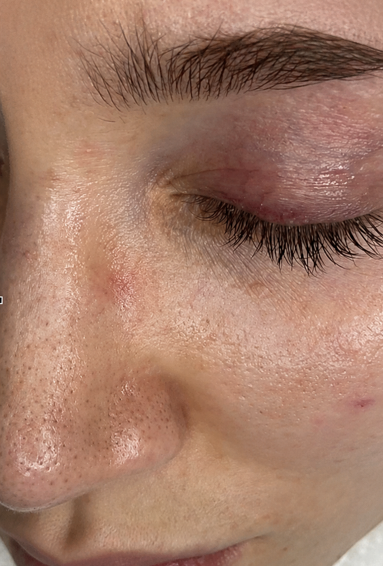 Vorher – Sama Skincare